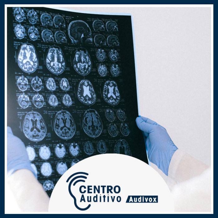 El Día del Cerebro