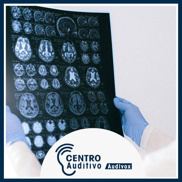 El Día del Cerebro